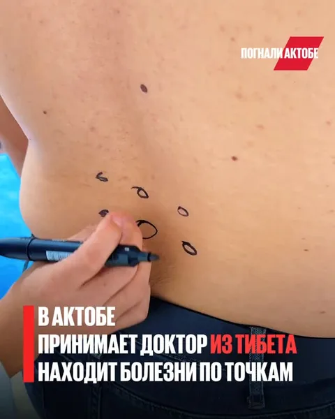 кадр из публикации центра: Диагностика по пульсу, лечение без таблеток, игло-моксотерапия, прогревающие моксо и…