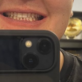 DentAll, стоматологиялық клиника, логотип