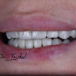Smile Concept, стоматологический центр, логотип