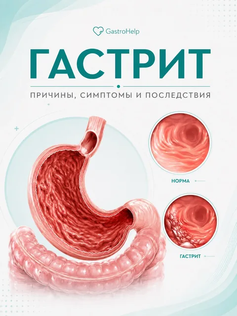 кадр из публикации центра: Гастрит: симптомы и что делать